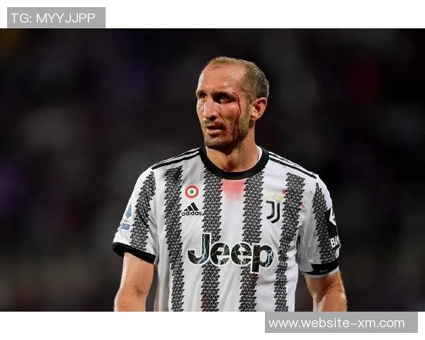 卡尔达拉深感遗憾未听基耶利尼劝告选择留在尤文图斯发展